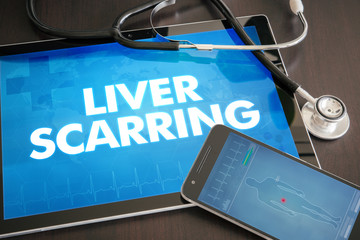 Liver scarring (liver disease related) diagnosis medical concept on tablet screen with stethoscope