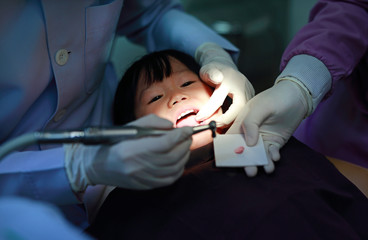 Little girl during dental extraction