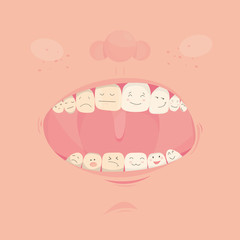 .Modern vector illustration of open cute mouth with cartoon friendly teeth..Before and After Bleaching treatment. Teeth whitening