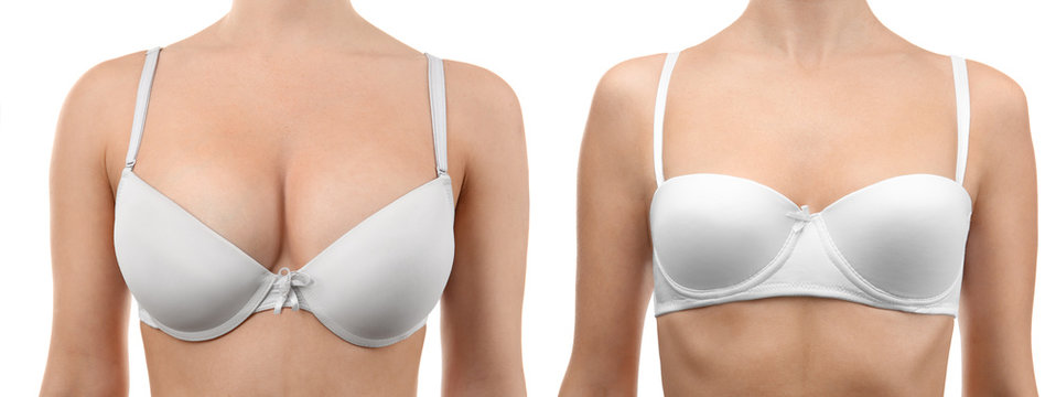 Woman before and after breast size correction on white background. Plastic surgery concept