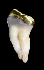 Human molar tooth