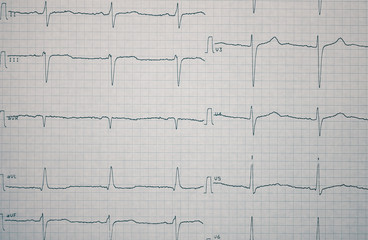 ECG record on the paper as a medical background