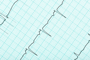 ECG diagnostics as a medical background