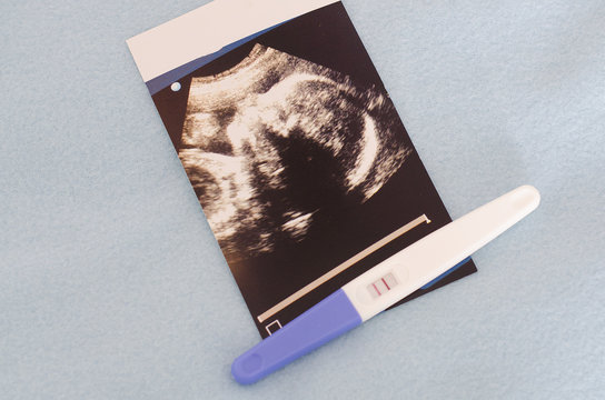 Ultrasound photo and pregnancy test on a blue cloth background