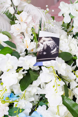 Concept photo ultrasound and pregnancy tests lie in the bouquet of orchids