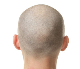 Hair loss concept. Head of man on white background, closeup