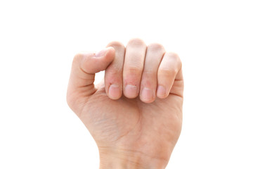 Bitten fingers close-up on a white background. Terribly badly bitten fingers of a hand. Stress. Nervousness. Habit. Depression. Till blood. Mutilated. Isolate