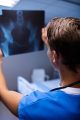 Male doctor examining x-ray report