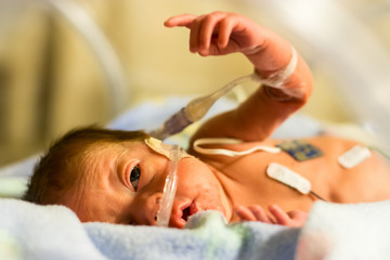 Obraz na płótnie Canvas Preemie baby girl pointing in her incubator