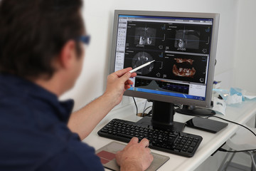 Dental x-rays being examined on computer screen by oral surgeon in a dental clinic