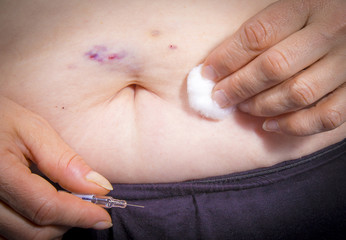 Adult woman self Injecting medical therapy with bruises on her stomach. Chemotherapy. Medical concept