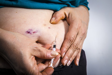 Adult woman self Injecting medical therapy with bruises on her stomach. Chemotherapy. Medical concept
