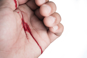 Hand of man injured wound from accident and blood bleeding on white background , insurance concept