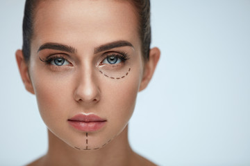 Plastic Surgery Operation. Woman Face With Black Surgical Lines