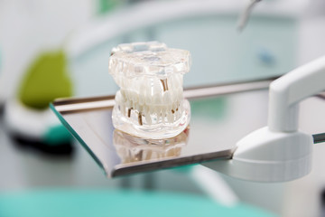 Model dentures in dental office