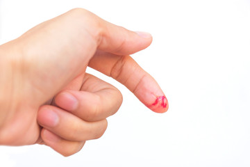 The area has been cut hand index finger bleeding.