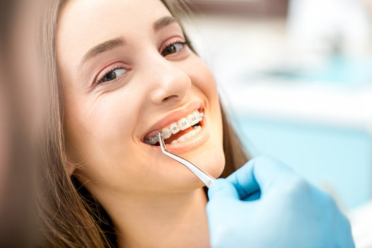 Putting dental braces to the woman's teeth at the dental office