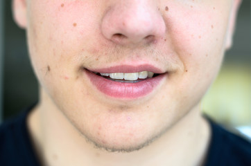 Lower face of a young man with lips ajar