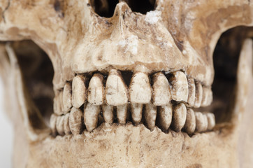 model of human teeth (skull) on a white background