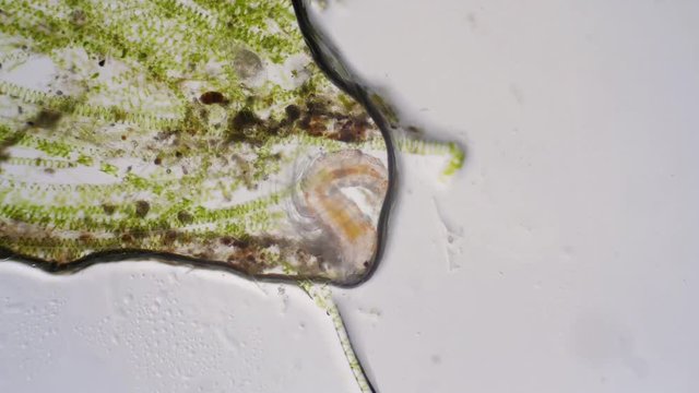 Pond life under the microscope