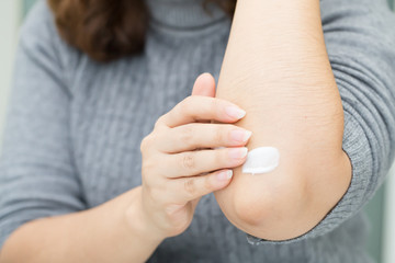 Woman takes care of elbow using cosmetic cream