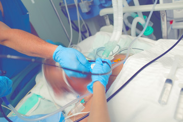 Medical procedure in the intensive care unit