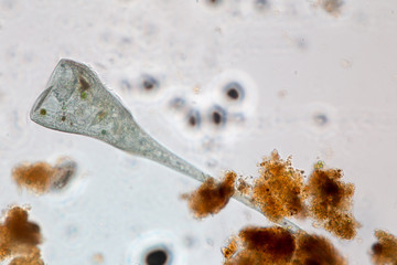 Stentor (ciliate) in waste water under the microscope.