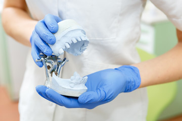 Dentist's hand hold dental gypsum model, close up photo