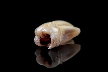 The remote tooth is damaged by caries on a black background. Macro.