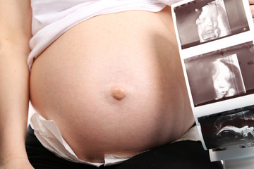 Brzuch ciążowy ze zdjęciem usg 