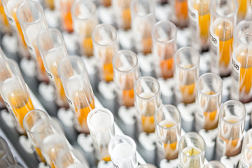 Laboratory glass test tubes filled with orange liquid for an experiment in a science research lab