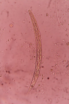 Strongyloides stercoralis