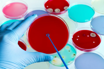 technician hand streaking petri dish in the lab / Hand of a microbiologist holding and inoculating petri plate in the laboratory