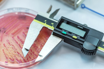 The Tools for measuring zone size of bacteria as sub sensitivity test for laboratory in the hospital.