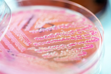 Close up the media plate on hand medical technicians working on bacterial culture and drug...