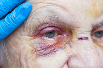 Injured elderly woman crying
