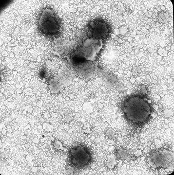 Liposomi osservati al microscopio elettronico