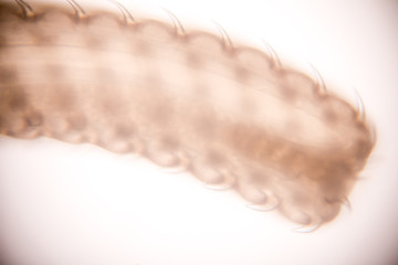 Moniliformis moniliformis (Thorny-head worm) of education in laboratory.