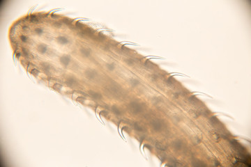 Moniliformis moniliformis (Thorny-head worm) of education in laboratory.
