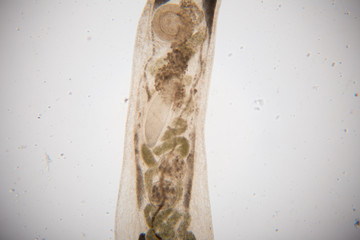 parasite under microscope view.