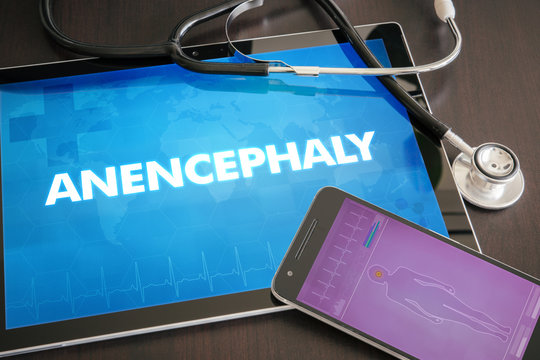 Anencephaly (congenital disorder) diagnosis medical concept on tablet screen with stethoscope