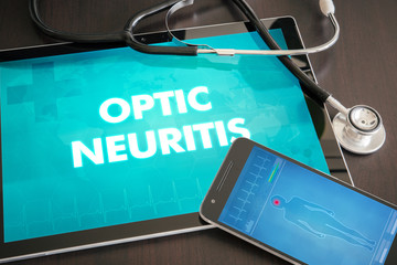 Optic neuritis (neurological disorder) diagnosis medical concept on tablet screen with stethoscope