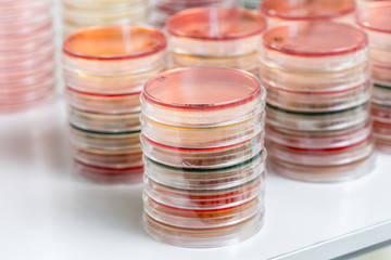 Red and yellow petri dishes stacks in microbiology lab on the bacteriology laboratory background.