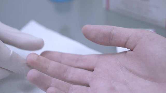 Puncture finger for blood testing. Close up of puncture finger blood test. Glove hand taking blood finger test. Taking blood sample. Closeup of medical needle shot. Medical analysis