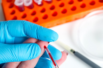 Taking blood for close-up analysis, a clinical blood test