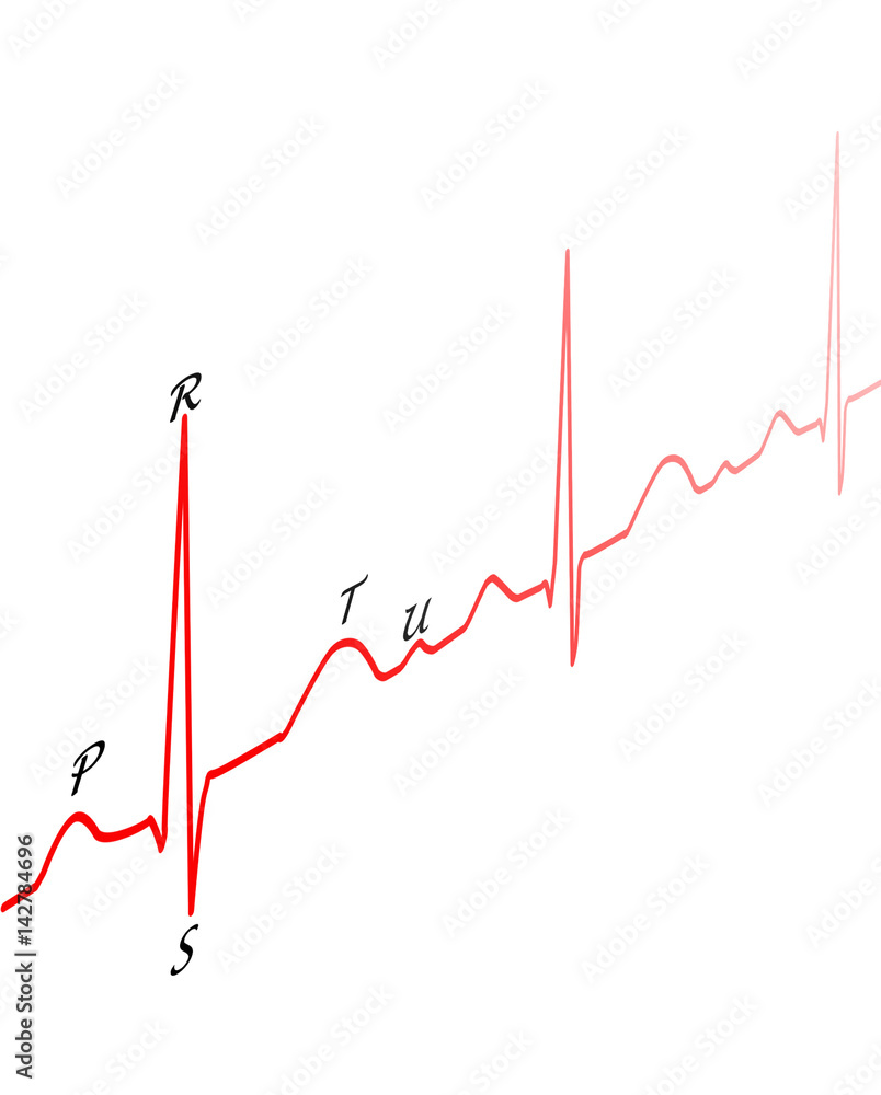 Canvas Prints drawing ECG