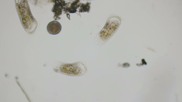 Paramecium and a rotifer's egg under the microscope in 4k