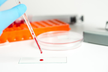 Test tubes with blood for analysis and research in the laboratory