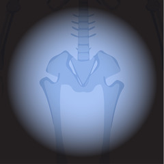 X ray hips. Human skeleton's part on black background.