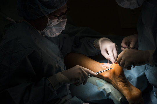 Surgeons making an Achilles tendon operation